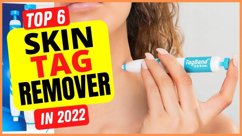 Top 5 skin tag removals of 2022